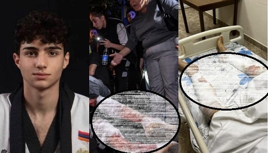 Ոստիկանության նետած նռնակներից վնասվել են չեմպիոն Իգոր Կարապետյանի ոտքերը